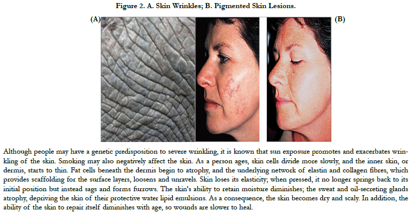 Treatment Of Skin Aging And Photoaging With Innovative Oral Dosage Forms Of Non Hydrolized Carnosine And Carcinine