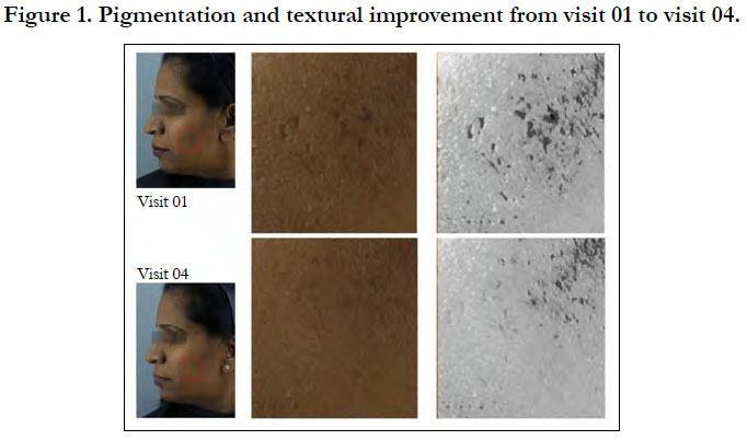 Evaluation of Efficacy of Advanced Sign Anti Aging Cream in Imparting ...